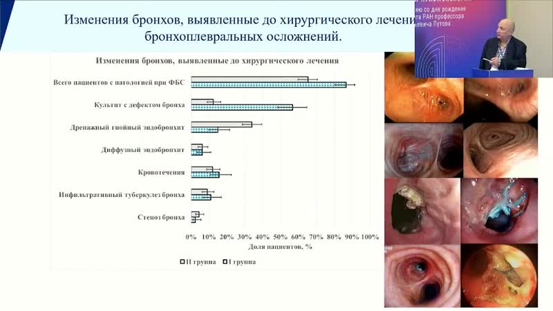 Хирургическое лечение бронхоплевральных осложнений после