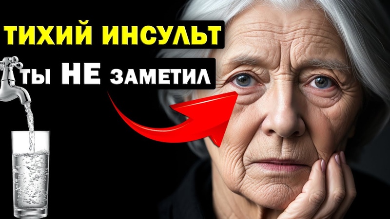 Тихий ИНСУЛЬТ. Вот как тело КРИЧИТ о нем А ты и не