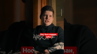 Вейп взорвался в руках  #интервью #спектр #вейпы #shorts