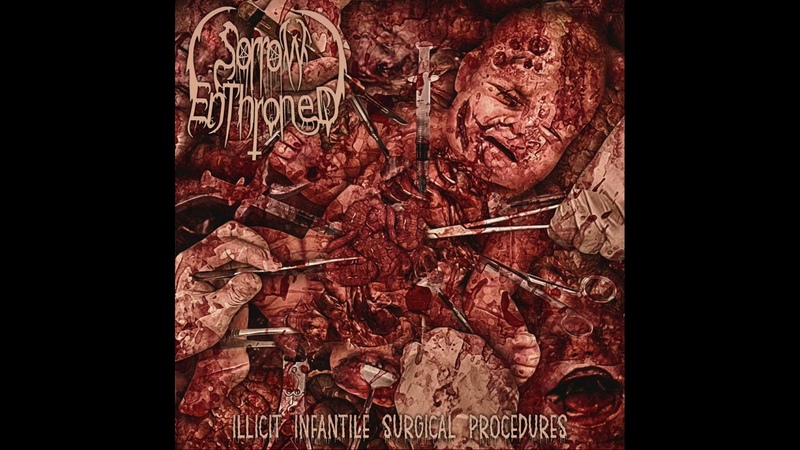 Sorrow Enthroned ( USA) Illicit Infantile Surgical Procedures ( Full