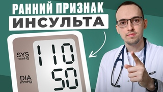 ТОП-5 ОПАСНЫХ Предвестников ИНСУЛЬТА. Как СПАСТИ СОСУДЫ Головного Мозга