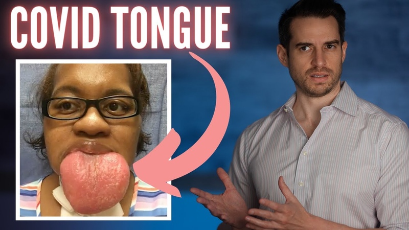 The Mystery of COVID Tongue