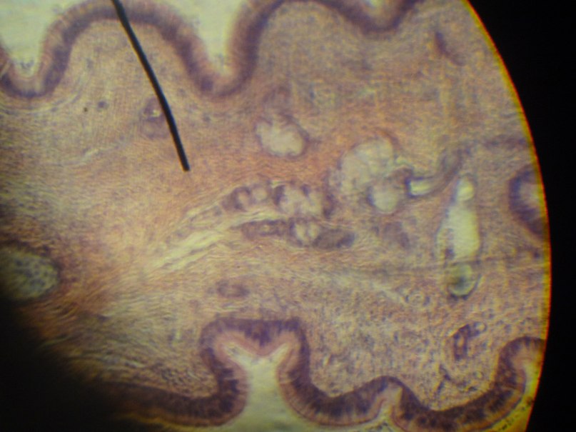 Анастасия Турчанинова Алексеевна | Новосибирск