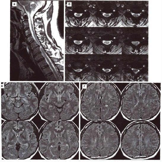 Ильдар Зиганшин | Казань