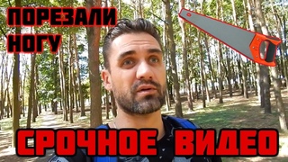 ПОРЕЗАЛИ НОГУ. СРОЧНОЕ ВИДЕО