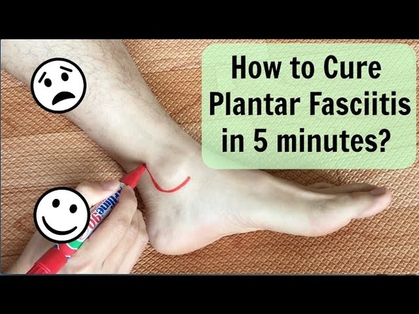 How To Cure Plantar Fasciitis( Heel Pain) in 5 minutes 如何在五分鐘內解決足底筋膜炎 , Chinese