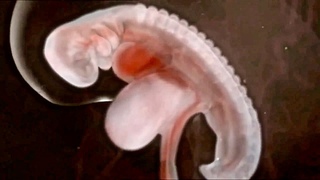 Amazing Animation of a Fetus Growing in the Womb